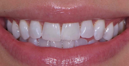 Before Image