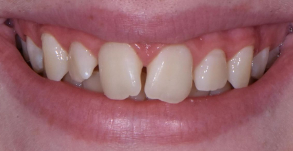 Before Image