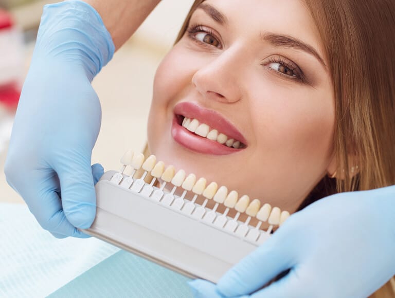 Dental Veneers